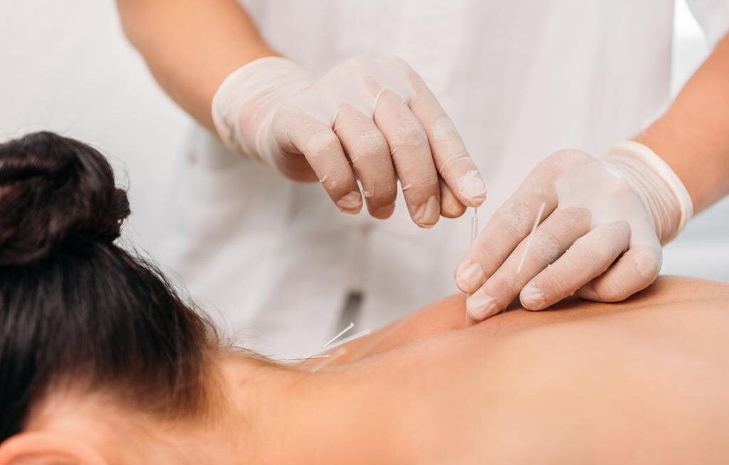 5 Health Conditions Acupuncture Can Ease