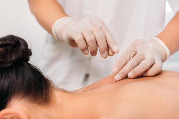 5 Health Conditions Acupuncture Can Ease
