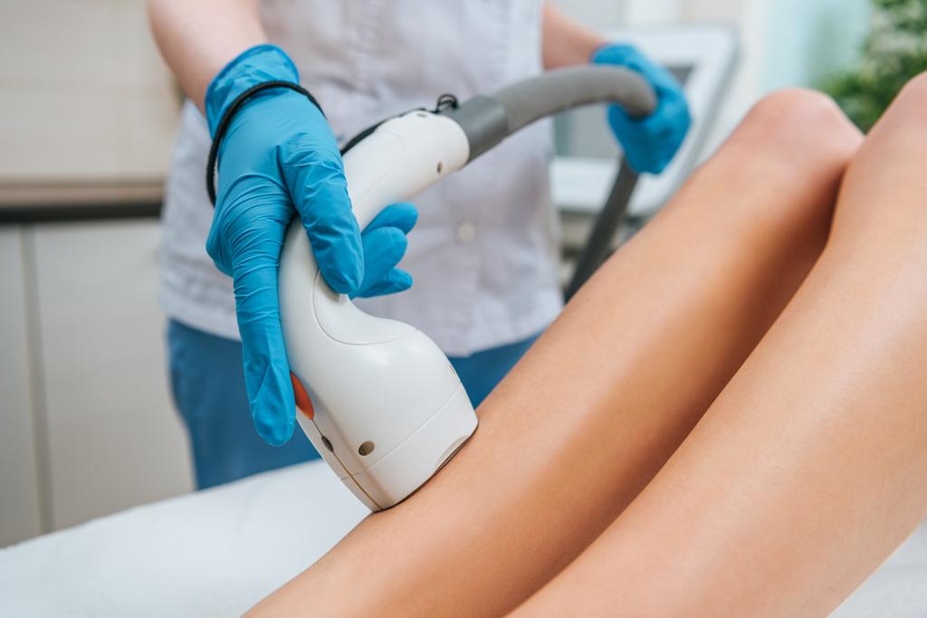 Laser Hair Removal