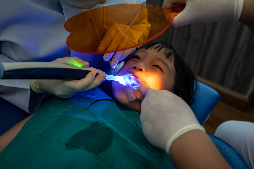 dental filling treatment 